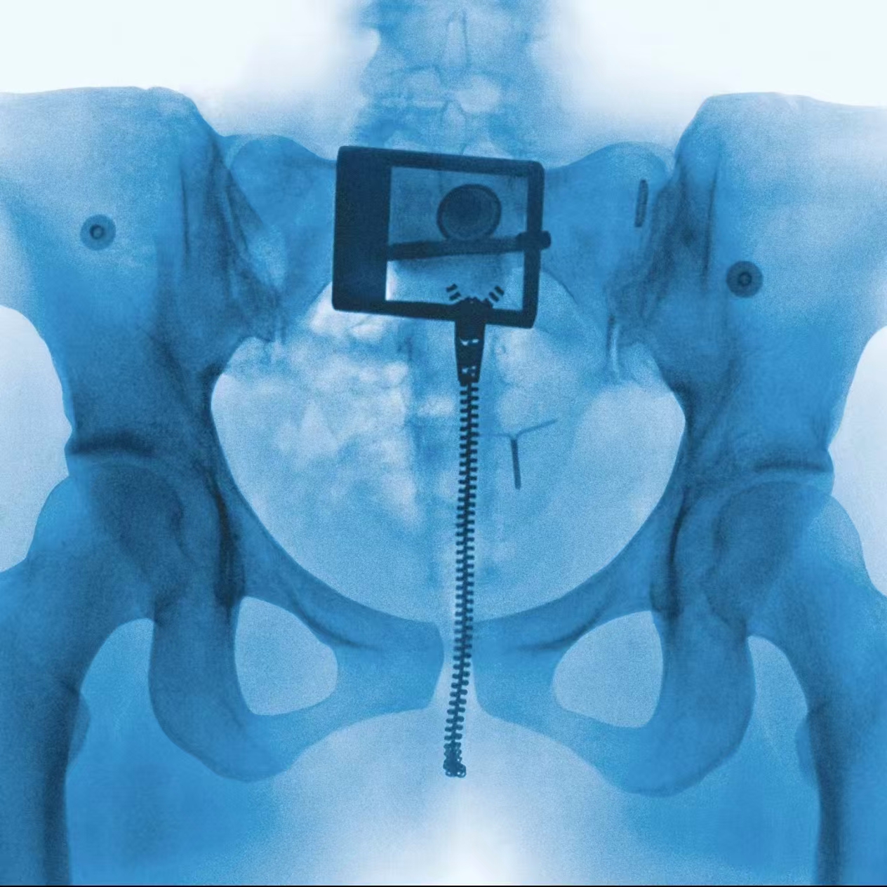 6936e9cd5ec9e.jpg 6936e9cd5ec9e.jpg